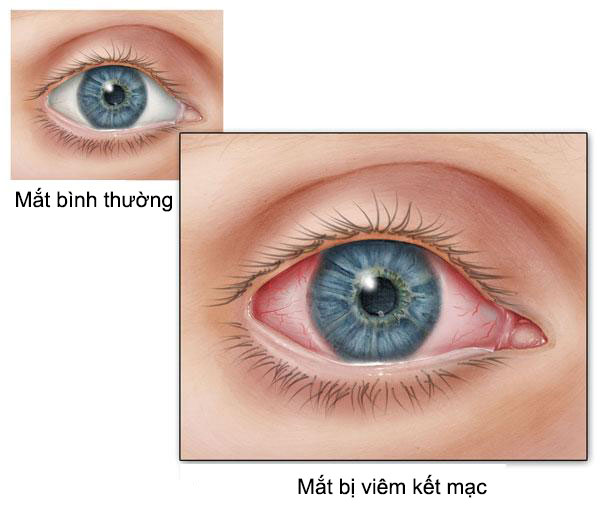 Điểm mặt những căn bệnh nguy hiểm thường gặp v&agrave;o m&ugrave;a h&egrave;