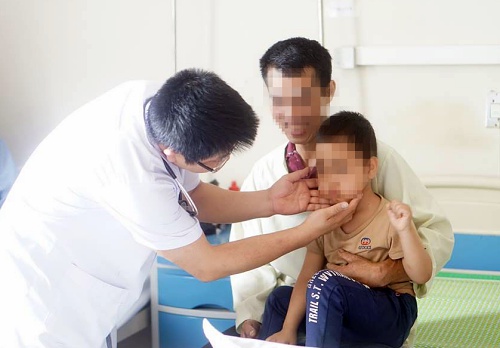 Lạm dụng thuốc Corticoid b&eacute; trai 5 tuổi bị suy thượng thận