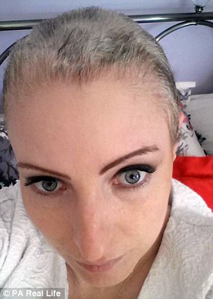 Kelly Lacey gần như hói chỉ sau một đêm