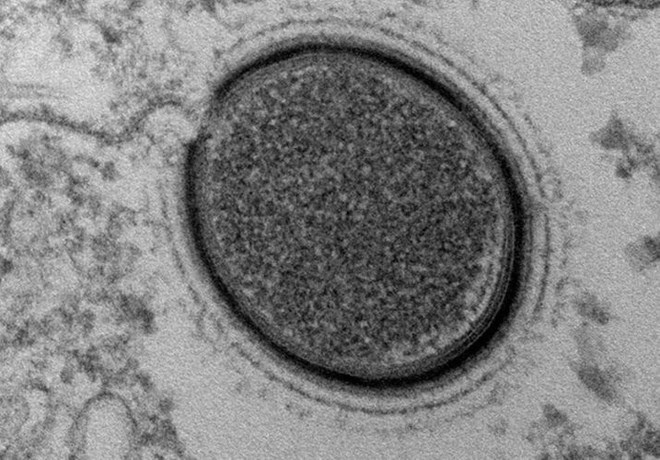 Đ&acirc;y l&agrave; chủng virus cổ đại thứ tư được t&igrave;m thấy từ năm 2003