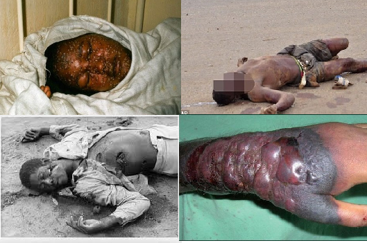 Nhiều người lo lắng v&igrave; khả năng đại dịch Ebola c&oacute; thể tới Việt Nam