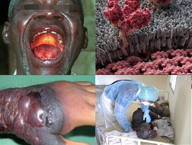 WHO tuy&ecirc;n bố Liberia khống chế th&agrave;nh c&ocirc;ng dịch Ebola