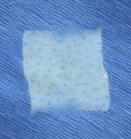 Tin khoa học giới thiệu t&aacute;c dụng của phương ph&aacute;p decellularization lọc rửa c&aacute;c tế b&agrave;o sẵn c&oacute; tr&ecirc;n da