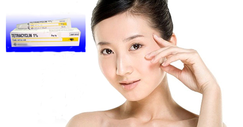 Tuyệt chi&ecirc;u trị mụn cấp tốc để đi du lịch dịp 30/4 chỉ với v&agrave;i ngh&igrave;n đồng