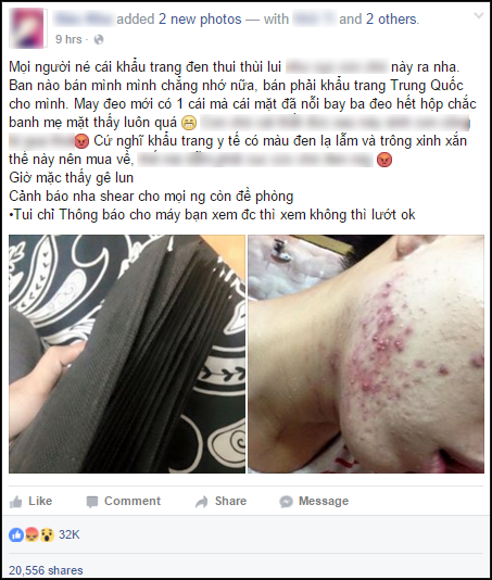Trong những ng&agrave;y gần đ&acirc;y, những biển b&aacute;o quảng c&aacute;o khẩu trang gi&aacute; rẻ giật m&igrave;nh 'mọc' l&ecirc;n tr&agrave;n lan tr&ecirc;n c&aacute;c vỉa h&egrave;, ven đường phố. Điều kh&ocirc;ng ai ngờ l&agrave; 90% sản phẩm đang được rao b&aacute;n s&ocirc;i nổi đ&oacute; lại xuất ph&aacute;t từ những &ldquo;đầu mối&rdquo; kh&ocirc;ng ai chứng nhận, kiểm so&aacute;t v&agrave; theo một số người 13Win18 đa dạng khuyến mãi th&igrave; đ&acirc;y ch&iacute;nh l&agrave; nguy&ecirc;n nh&acirc;n g&acirc;y của triệu chứng mẩn ngứa, mụn đỏ, lở lo&eacute;t  Theo quan s&aacute;t thị trường,  những sản phẩm n&agrave;y thường th&igrave; chỉ c&oacute; gi&aacute; 25.000 - 40.000đ/hộp 50 c&aacute;i. Theo th&ocirc;ng tin ghi tr&ecirc;n hộp th&igrave; hầu hết c&aacute;c khẩu trang đều ghi xuất xứ l&agrave; Made in Vietnam hoặc Malaysia...  Sản phẩm n&agrave;y được 'đ&aacute;nh b&oacute;ng' bằng những lời quảng c&aacute;o:  &ldquo;Khẩu trang ba lớp lọc hiệu quả 99% vi khuẩn, ngăn bụi bẩn, kh&ocirc;ng kh&iacute; độc hại&hellip;&rdquo; nhưng khi qua kiểm tra cụ thể th&igrave; chiếc khẩu trang y tế n&agrave;y rất mỏng từ d&acirc;y quai cho đến phần lớp vải đều sơ s&agrave;i v&agrave; mỏng kh&ocirc;ng đảm bảo 3 lớp như những th&ocirc;ng tin ghi tr&ecirc;n họp, nhiều hộp gi&aacute; rẻ c&ograve;n c&oacute; m&ugrave;i rất kh&oacute; chịu, khi gặp nước l&atilde; l&agrave; bở ra, lớp trong c&ugrave;ng như giấy vệ sinh.