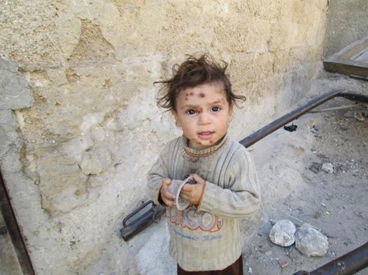 Trong nửa đầu năm 2013, Syria ghi nhận 41.000 người mắc căn bệnh Leishmaniasis.