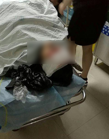 B&agrave; Wang hiện đang h&ocirc;n m&ecirc; v&agrave; chưa qua cơn nguy kịch. Ảnh: Shanghaiist