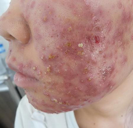 H&atilde;i h&ugrave;ng 'ti&ecirc;n dược l&agrave;m đẹp' si&ecirc;u rẻ v&agrave; những hệ lụy kh&ocirc;n lường