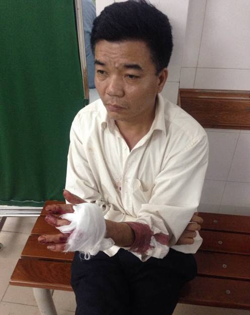 Bảo vệ Nguyễn Đo&agrave;n Bộ bị ch&eacute;m đứt g&acirc;n tay