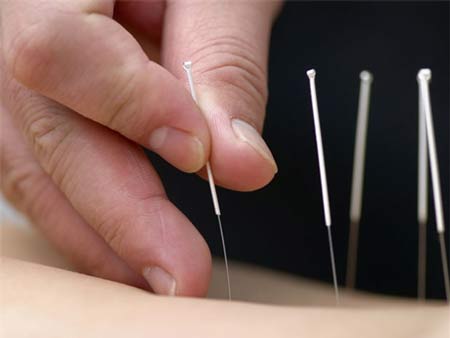 Kh&ocirc;ng phải ai cũng c&oacute; thể chữa bệnh bằng phương ph&aacute;p ch&acirc;m cứu.