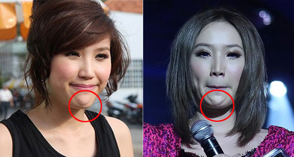 Ngay từ khi mới vào nghề, Bảo Thy đã dính nghi án tu sửa nhan sắc. Tuy nhiên, cô luôn phủ nhận việc này. Cô còn khẳng định: Nếu tôi đã từng chỉnh sửa gì trên người, thì tôi sẵn sàng nhận chứ không có gì phải sợ. Nhưng tôi khẳng định một lần nữa ngoài việc làm răng, tôi chưa từng đụng đến dao kéo. 