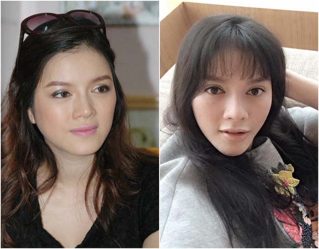 Sau nghi án mình phẫu thuật thẩm mĩ, Lý Nhã Kì đã lên tiếng phủ nhận kèm theo những hành động và lời nói chắc chắn cho rằng việc khuôn mặt khác biệt chỉ là do góc chụp ảnh.
