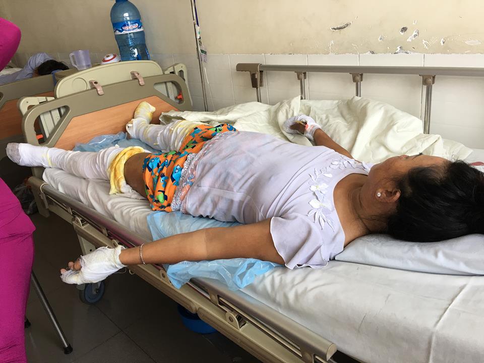 H&oacute;a &lsquo;đuốc sống&rsquo; sau khi d&ugrave;ng xăng đốt cả nh&agrave; người t&igrave;nh