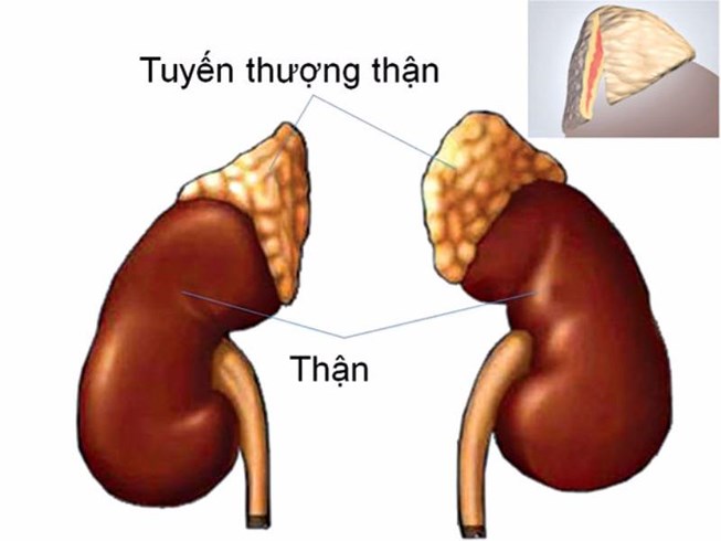 Đau bụng k&egrave;m theo sốt cẩn thận kẻo b&eacute; mắc bệnh nguy hiểm &lsquo;chết người&rsquo; n&agrave;y
