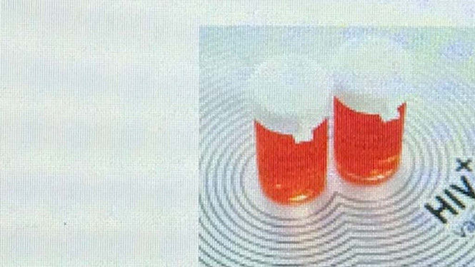 Vụ cả l&agrave;ng nghi nhiễm HIV ở Ph&uacute; Thọ: Phơi nhiễm l&agrave; g&igrave; v&agrave; cần l&agrave;m g&igrave; để tr&aacute;nh &lsquo;mất mạng&rsquo;?