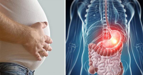 Đầy hơi: Dấu hiệu cảnh b&aacute;o 5 căn bệnh ung thư nguy hiểm 