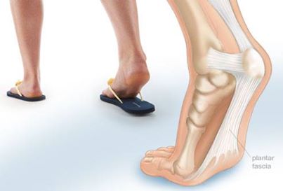D&eacute;p t&ocirc;ng dễ g&acirc;y tổn thương do ng&oacute;n ch&acirc;n. 
