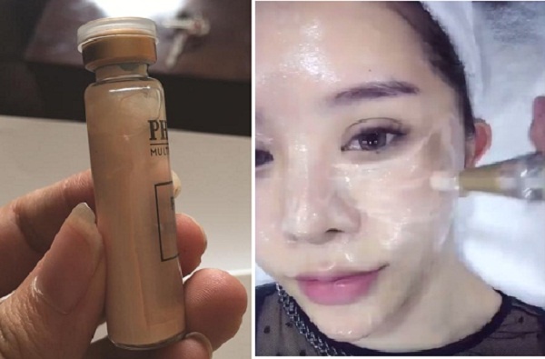 H&atilde;y coi chừng khi d&ugrave;ng phương ph&aacute;p cấy phấn cho da. 