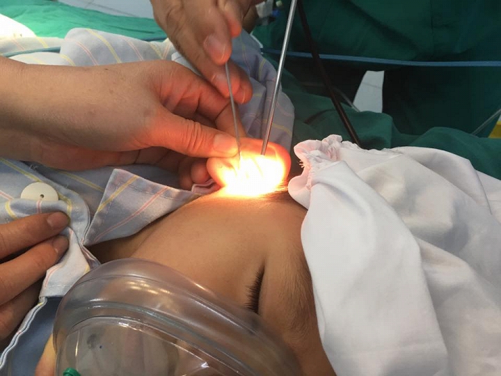  Trẻ nhỏ rất hiếu động n&ecirc;n cha mẹ h&atilde;y cảnh gi&aacute;c khi cho con trẻ chơi đồ chơi. 