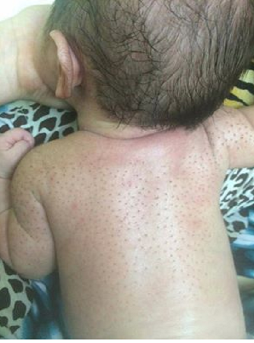  H&igrave;nh ảnh một b&eacute; sơ sinh đ&atilde; được cạo l&ocirc;ng tơ được chia sẻ tr&ecirc;n mạng x&atilde; hội. 
