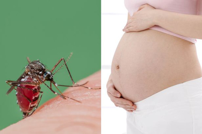 Thai phụ mắc bệnh Zika d&ugrave; nhẹ cũng khiến thai nhi dị tật. Ảnh minh họa 
