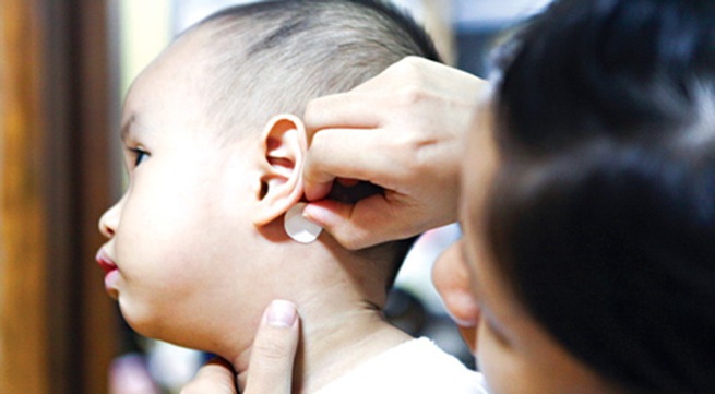 Miếng d&aacute;n chống n&ocirc;n d&ugrave;ng cho trẻ em v&ocirc; c&ugrave;ng nguy hiểm. Ảnh minh họa 