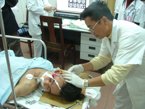 Tuy nhi&ecirc;n nếu sử dụng mũ bảo hiểm rởm sẽ g&acirc;y hậu quả kh&ocirc;n lường mỗi khi bị tai nạn giao th&ocirc;ng. Ảnh: minh họa