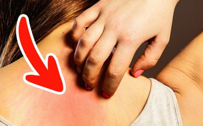 Hiện tượng ngứa ngo&agrave;i ra l&agrave; một biểu hiện cần cảnh gi&aacute;c ung thư sớm. Ảnh minh họa