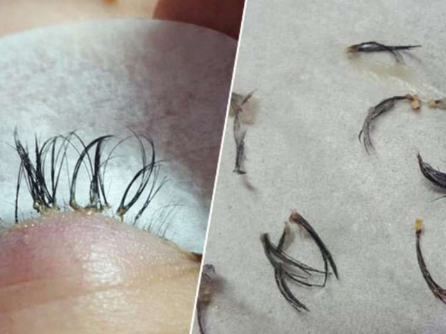Nối mi giả tiềm ẩn nhiều nguy cơ. Ảnh minh họa 