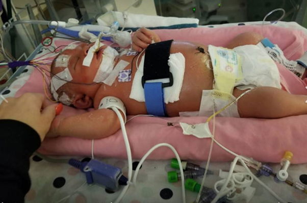Melody bị tổn thương n&atilde;o do nhiễm virus từ một nụ h&ocirc;n của người lớn. Ảnh: Thanh ni&ecirc;n