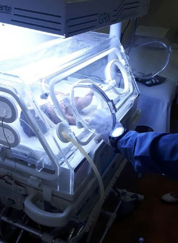 B&eacute; g&aacute;i sơ sinh được chăm s&oacute;c đặc biệt tại bệnh viện sau khi được cứu sống thần kỳ. Video: Amazing