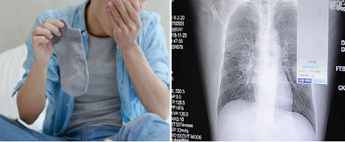  Người đ&agrave;n &ocirc;ng đ&atilde; bị vi&ecirc;m phổi do th&oacute;i quen ngửi tất bẩn