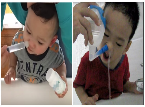 Rửa mũi cho con v&agrave;o m&ugrave;a đ&ocirc;ng mẹ n&ecirc;n thận trọng