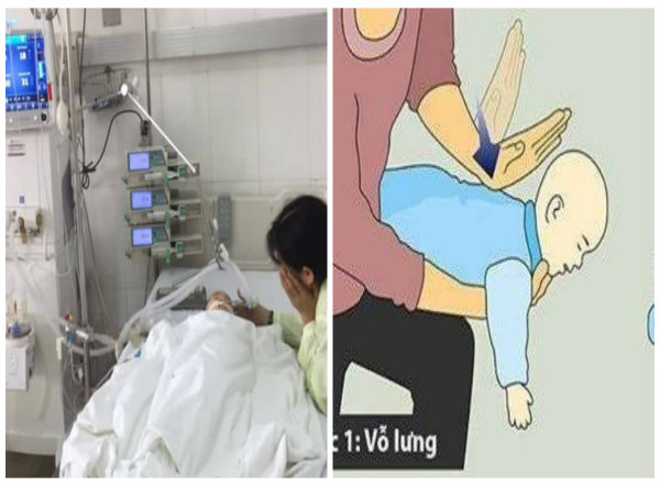 Trẻ bị sặc chuối ti&ecirc;u su&yacute;t chết, cha mẹ n&ecirc;n học c&aacute;ch cấp cứu để xử l&yacute; nhanh nếu trẻ kh&ocirc;ng may bị sặc 13Win1 nhập link nhà cái