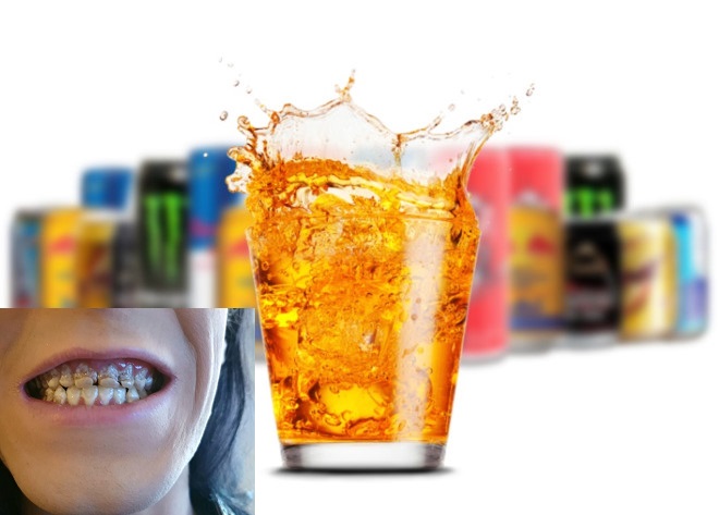 Uống nhiều nước tăng lực c&oacute; thể g&acirc;y mục răng, huyết &aacute;p cao...