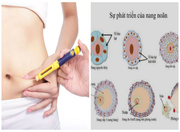 Ti&ecirc;m thuốc k&iacute;ch trứng v&ocirc; c&ugrave;ng nguy hiểm chị em n&ecirc;n c&acirc;n nhắc khi thực hiện 