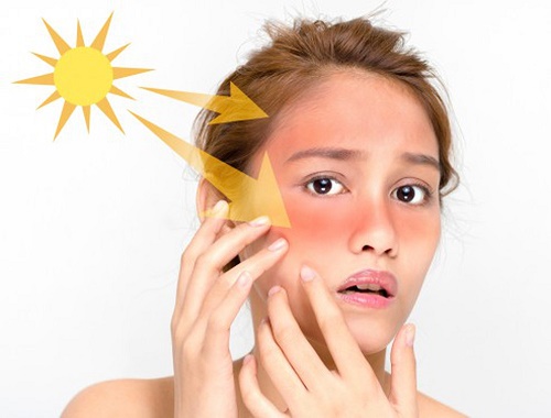  D&ugrave;ng kem chống nắng sai c&aacute;ch rất nguy hiểm cho l&agrave;n da