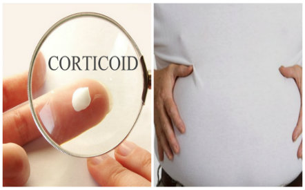 Do sử dụng thuốc chứa corticoid người đ&agrave;n &ocirc;ng đ&atilde; phải nhập viện do trướng bụng, xơ gan  