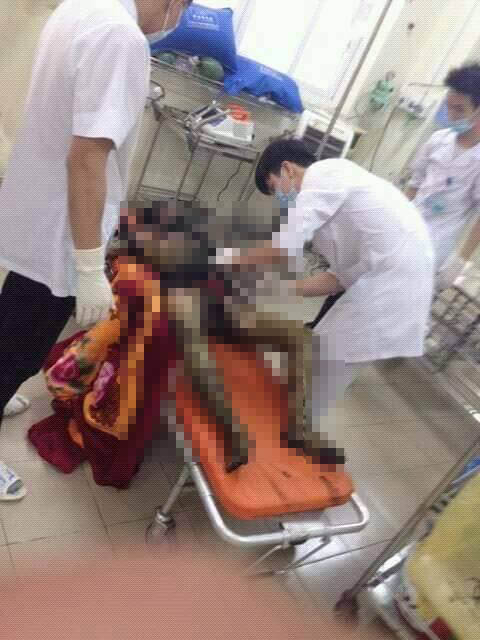ngọn lửa khiến người vợ bị thương nặng, c&ograve;n chồng đ&atilde; tử vong