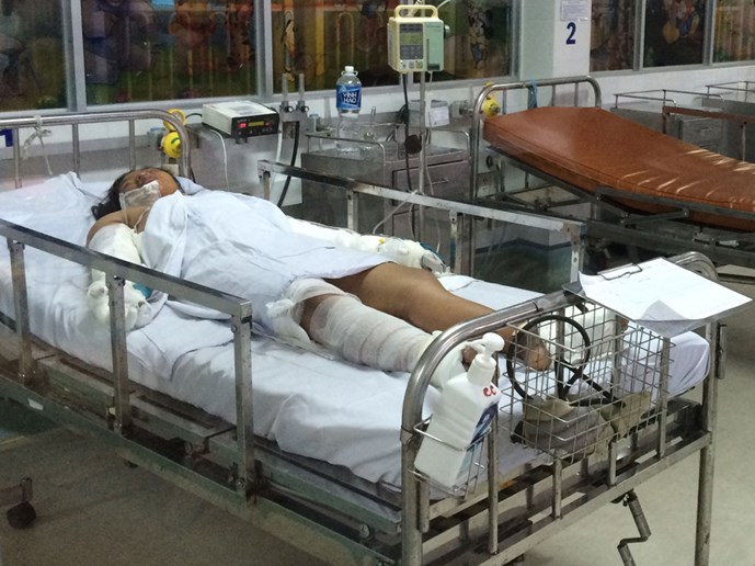 B&eacute; Linh đang được điều trị t&iacute;ch cực sau khi bị mẹ tưới xăng đốt