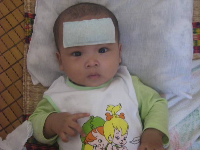 Một số b&aacute;c sĩ cho rằng sử dụng miếng d&aacute;n hạ sốt g&acirc;y ra lời bất cập hại