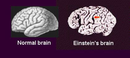 Bộ não của nhà bác học Albert Einstein Bộ não của nhà bác học Albert Einstein