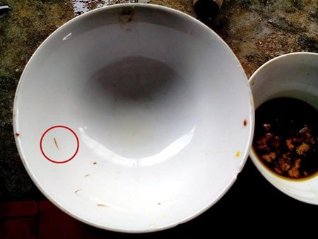 Sợ canh cua đ&ocirc;̀ng vì th&acirc;́y ký sinh trùng do kh&ocirc;ng hi&ecirc;̉u rõ v&ecirc;̀ loại ký sinh 