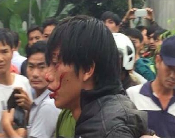 Nghịch tử ch&eacute;m chết b&aacute;c v&agrave; trọng thương bố, ch&uacute; ruột