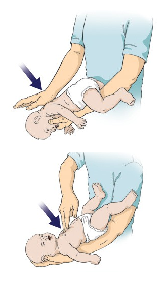 H&oacute;c hạt vải, b&eacute; trai được mẹ cứu sống nhờ học cấp cứu tr&ecirc;n ti vi