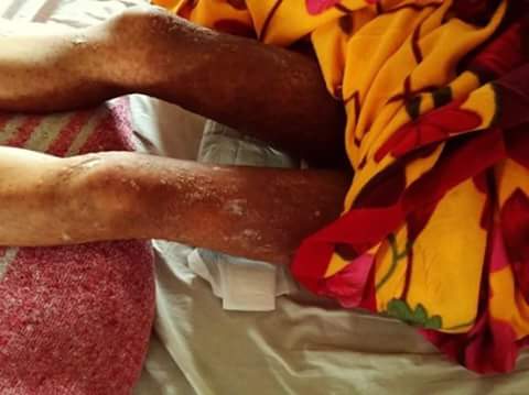 Nước tăng lực Rồng Đỏ bị nghi g&acirc;y ngộ độc cho b&eacute; g&aacute;i 11 tuổi?