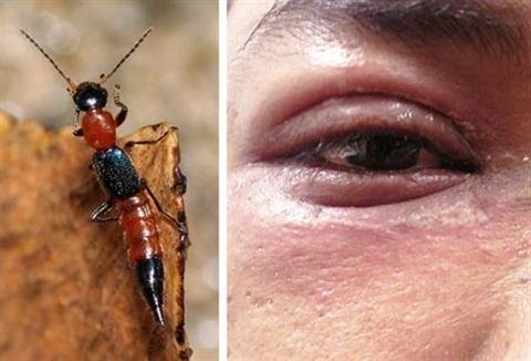 Kiến 3 khoang v&agrave;o m&ugrave;a, chuy&ecirc;n gia m&aacute;ch c&aacute;ch &lsquo;trị&rsquo;