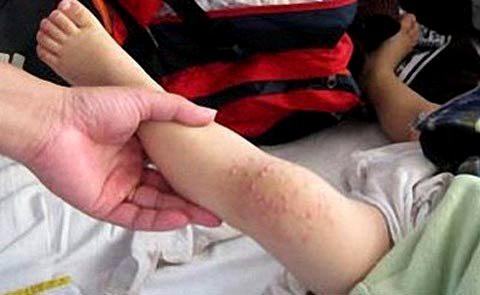 Sốt xuất huyết 'tăng nhiệt', H&agrave; Nội chi th&ecirc;m 14 tỷ đồng đối ph&oacute;