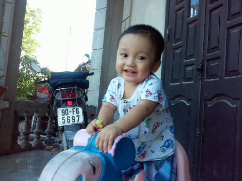 Cứu sống trẻ suy giảm miễn dịch bẩm sinh bằng gh&eacute;p tế b&agrave;o gốc 