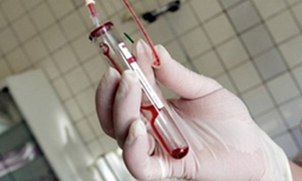 H&agrave; Nội: Hơn 90% địa phương c&oacute; người nhiễm HIV
